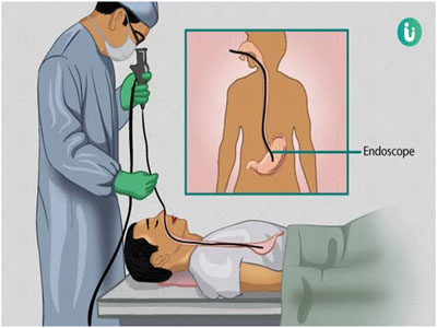 Endoscopy Surgeon In Satara Dr Pramod Rajbhoi